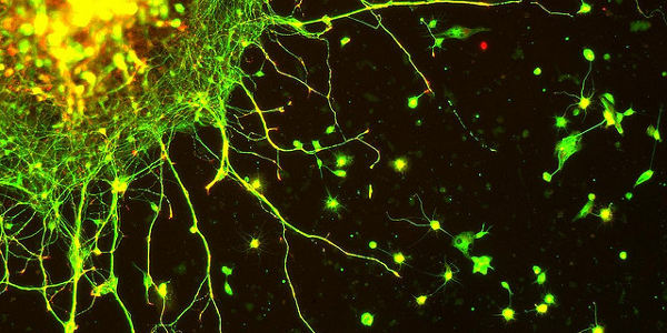 Répétition espacée - réseau de neurones